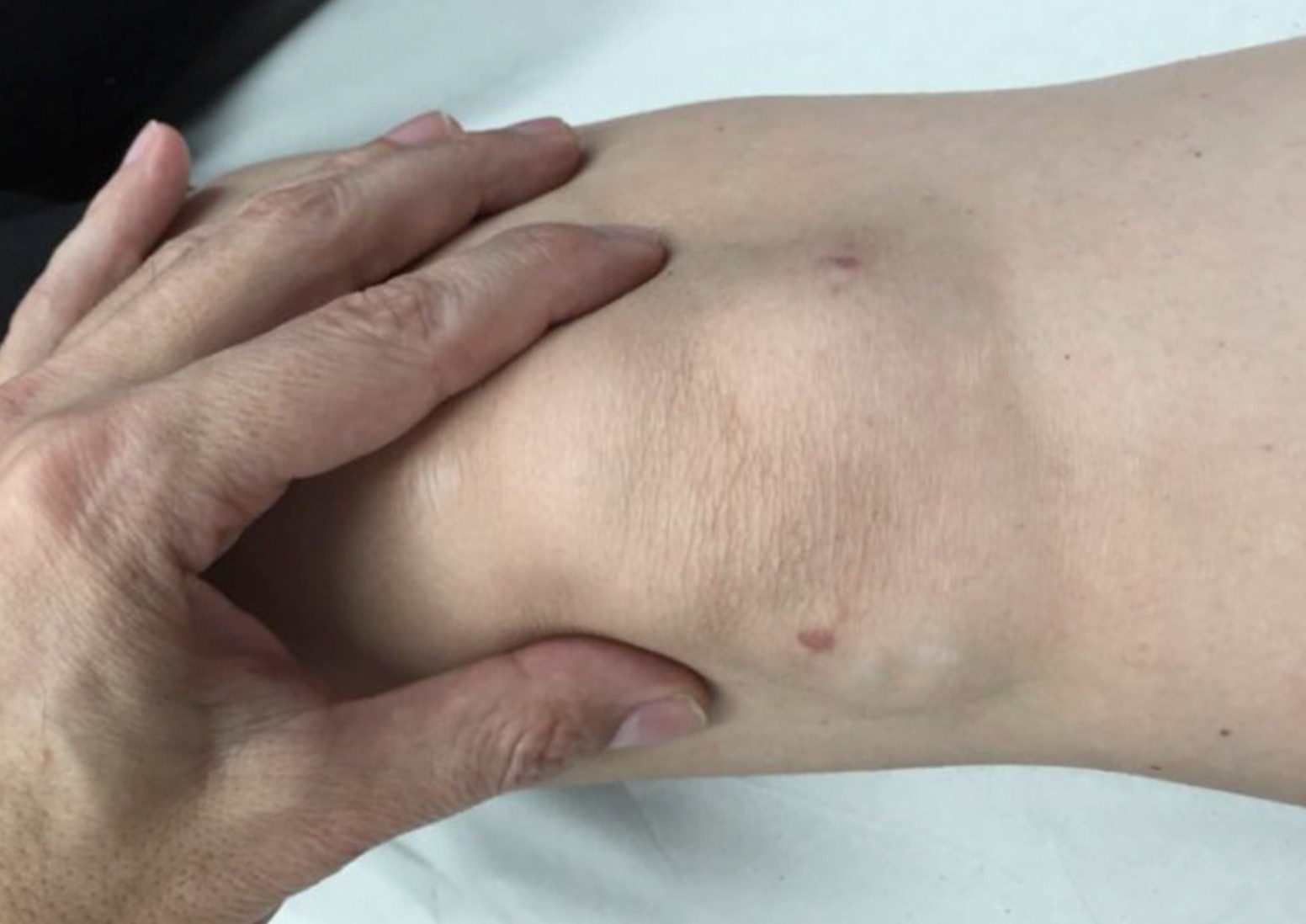 What causes a sharp pain on the outside-inside of my knee?