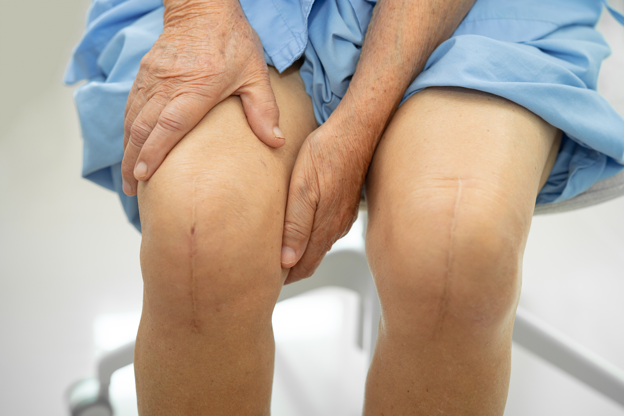 Cost of Knee Replacement in the UK: NHS vs Private, Implant Choices and Long-Term Value (2026 Definitive Guide)
