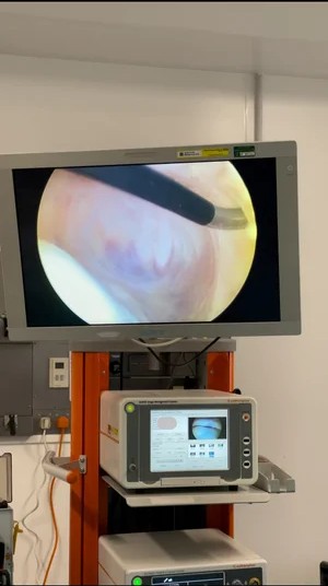 Keyhole arthroscopy and meniscus surgery