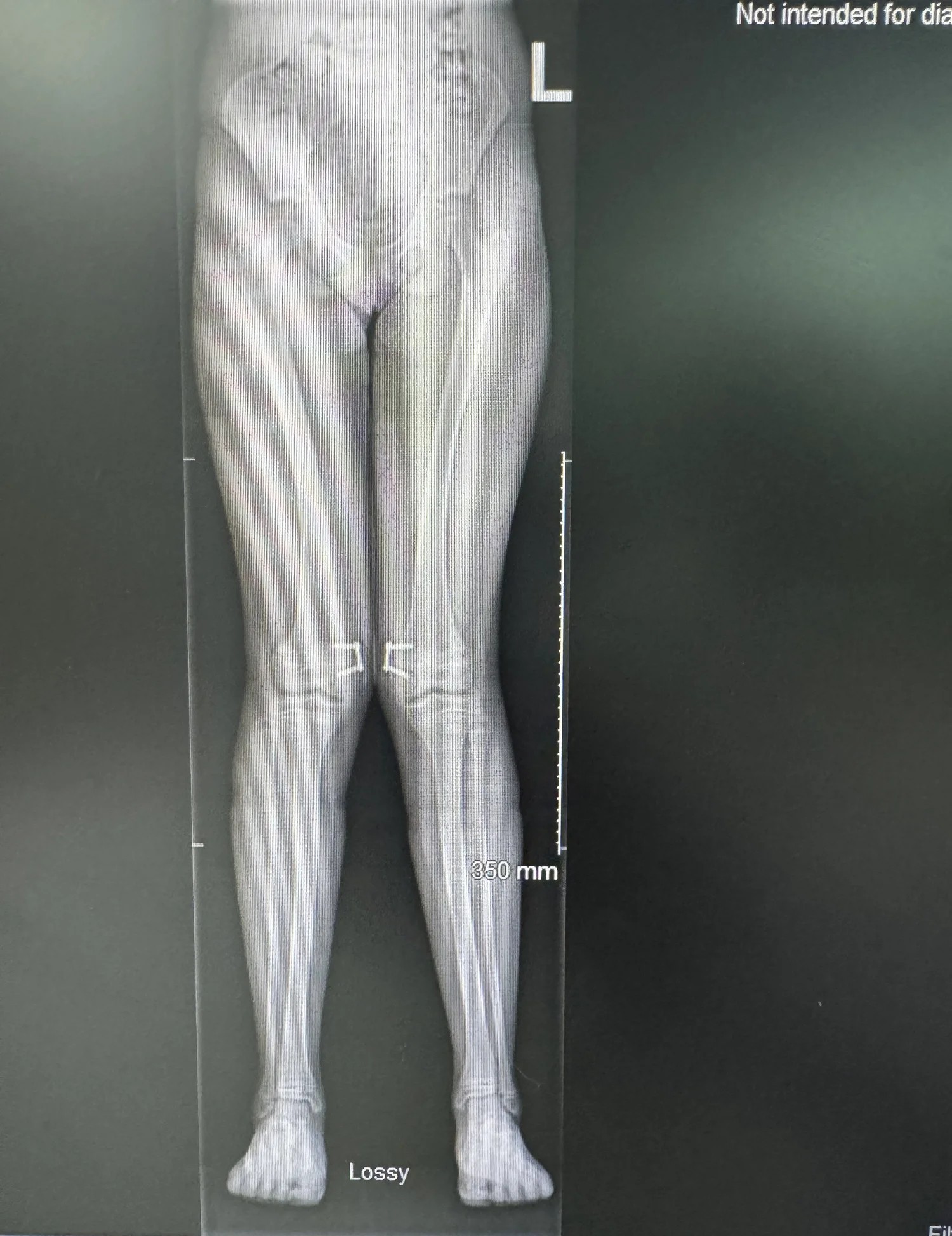 What types of surgery are there?
