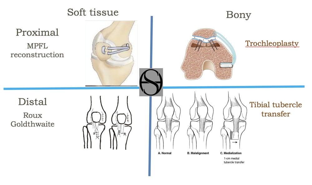 What are the different surgeries for kneecap dislocation?