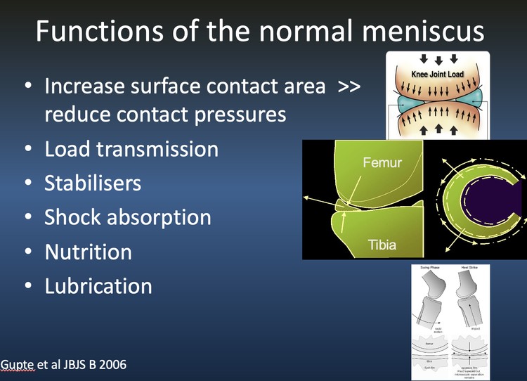 Is a meniscus the same as a cartilage?