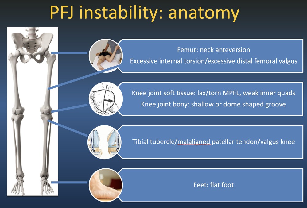 What causes patellofemoral instability (dislocating kneecap)?