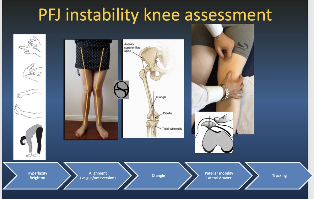How do you examine a dislocating kneecap?
